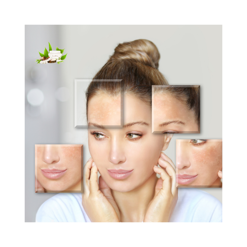 Естествено изсветляване на хиперпигментация